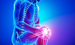 etapas de la artrosis de la articulación de la rodilla
