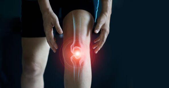 Artrosis de la articulación de la rodilla
