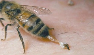 tratamiento de la artrosis de cadera por abejas